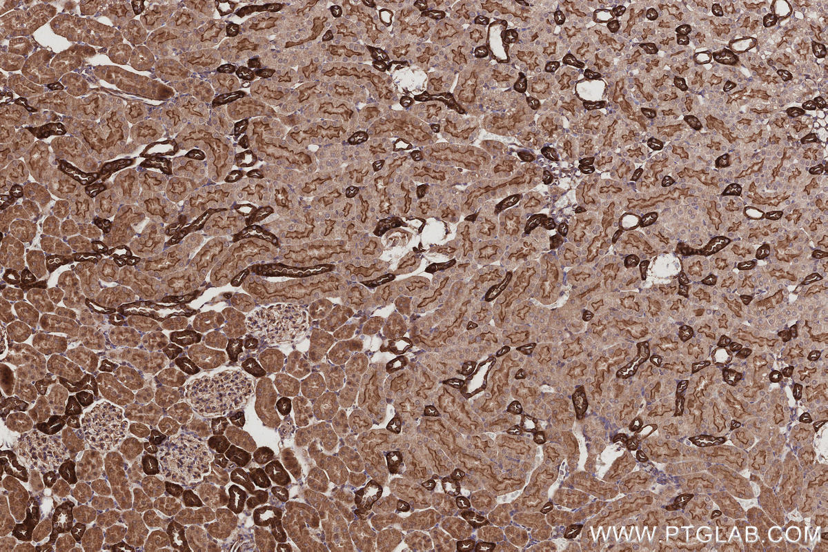 Immunohistochemistry (IHC) staining of rat kidney tissue using EPLIN Polyclonal antibody (16639-1-AP)