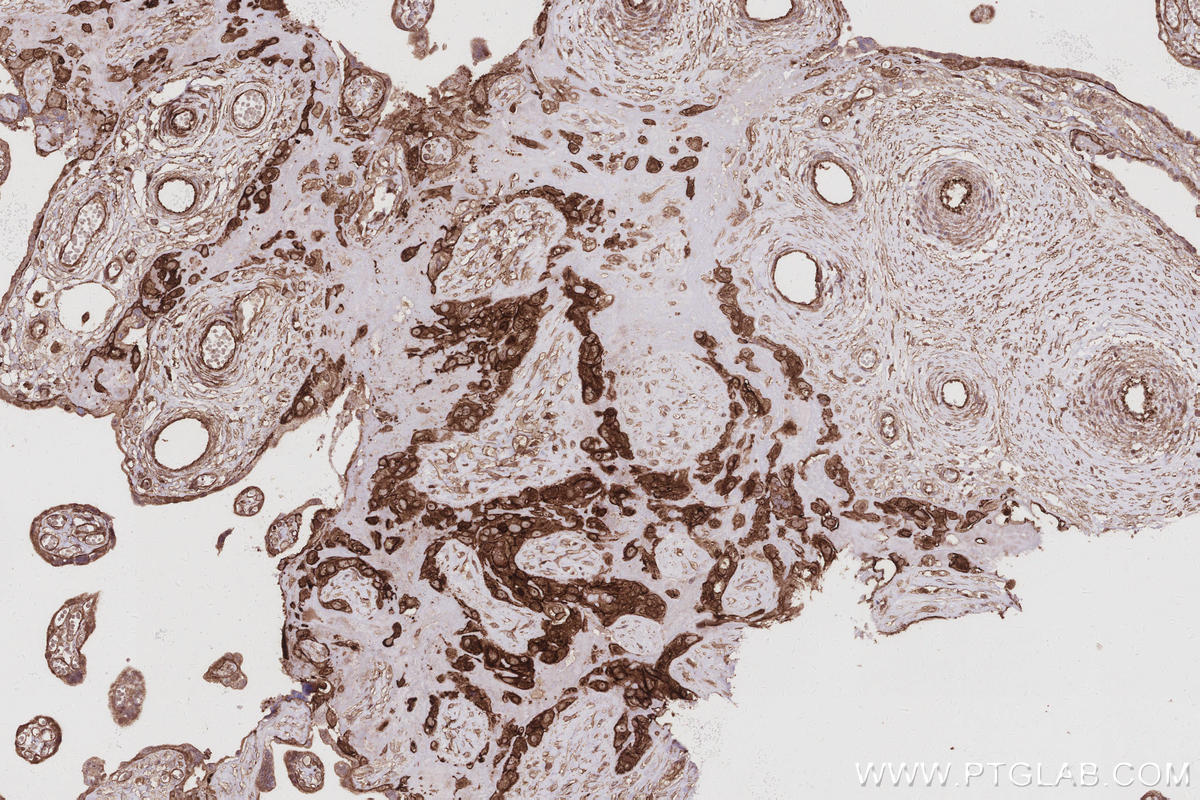 Immunohistochemistry (IHC) staining of human placenta tissue using EPLIN Polyclonal antibody (16639-1-AP)