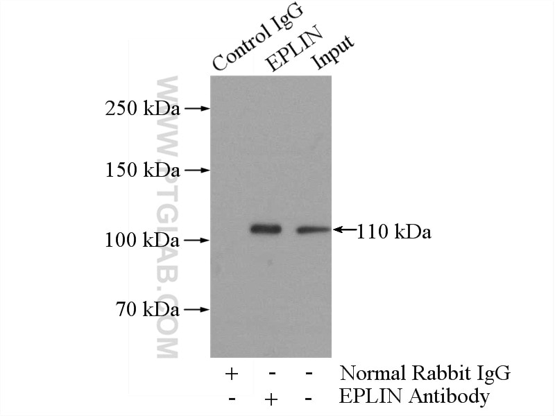 Immunoprecipitation (IP) experiment of mouse liver tissue using EPLIN Polyclonal antibody (16639-1-AP)