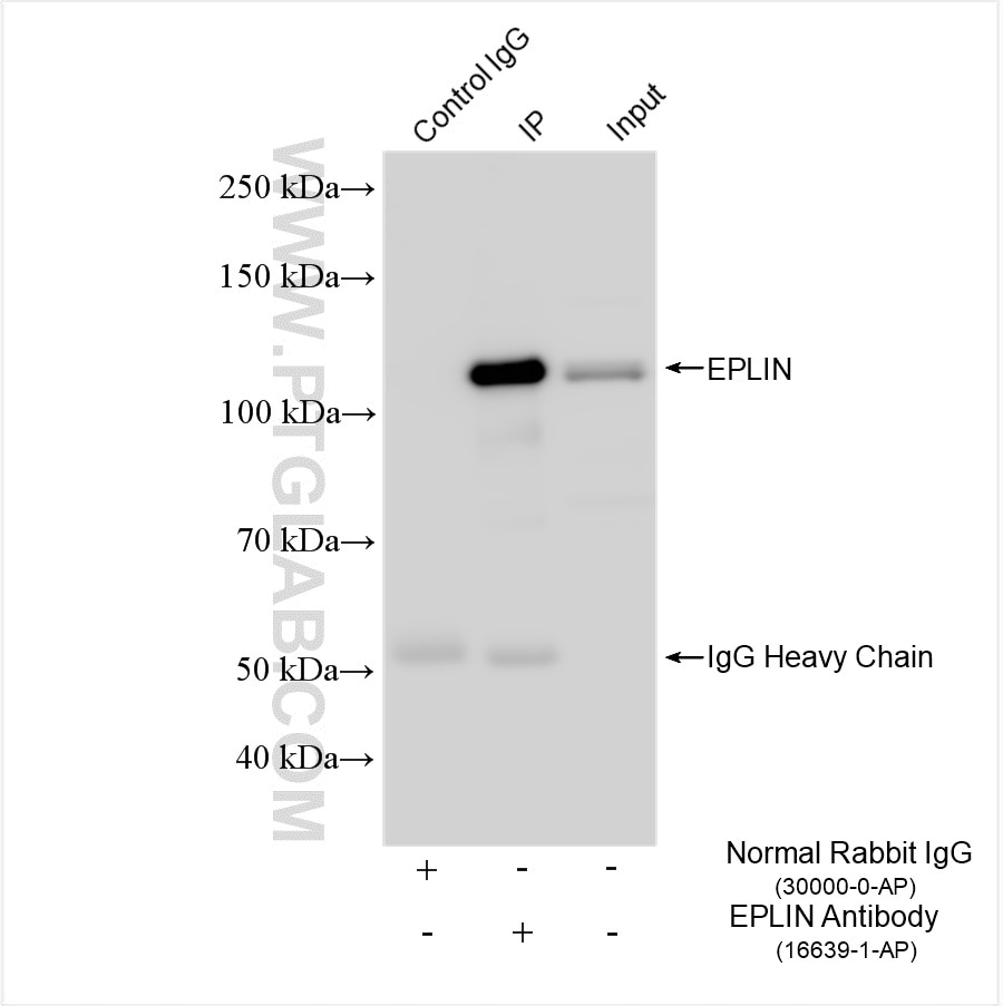 Immunoprecipitation (IP) experiment of HepG2 cells using EPLIN Polyclonal antibody (16639-1-AP)