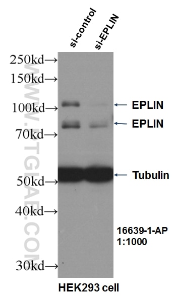 Western Blot (WB) analysis of HEK-293 cells using EPLIN Polyclonal antibody (16639-1-AP)