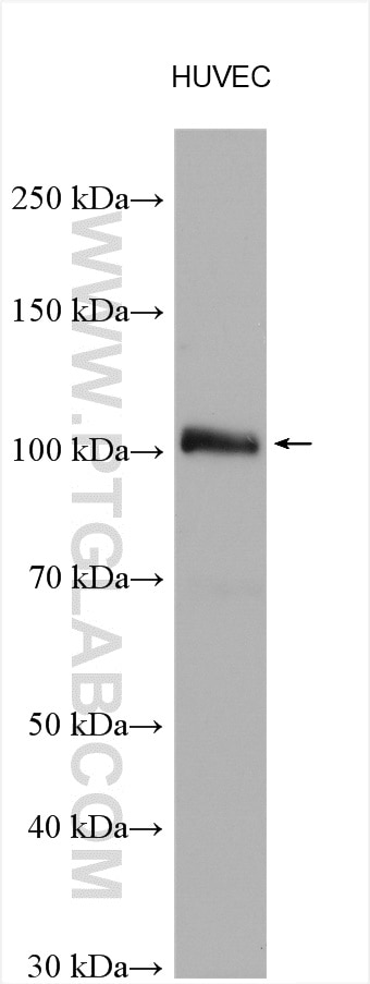 Western Blot (WB) analysis of HUVEC cells using EPLIN Polyclonal antibody (16639-1-AP)