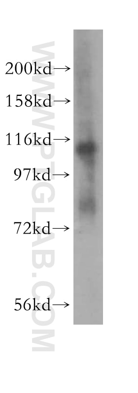 Western Blot (WB) analysis of human placenta tissue using EPLIN Polyclonal antibody (16639-1-AP)