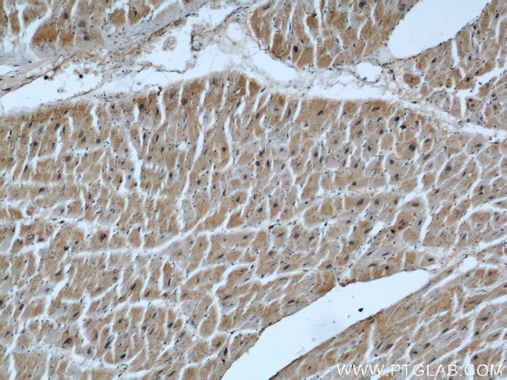 IHC staining of human heart using 66071-1-Ig