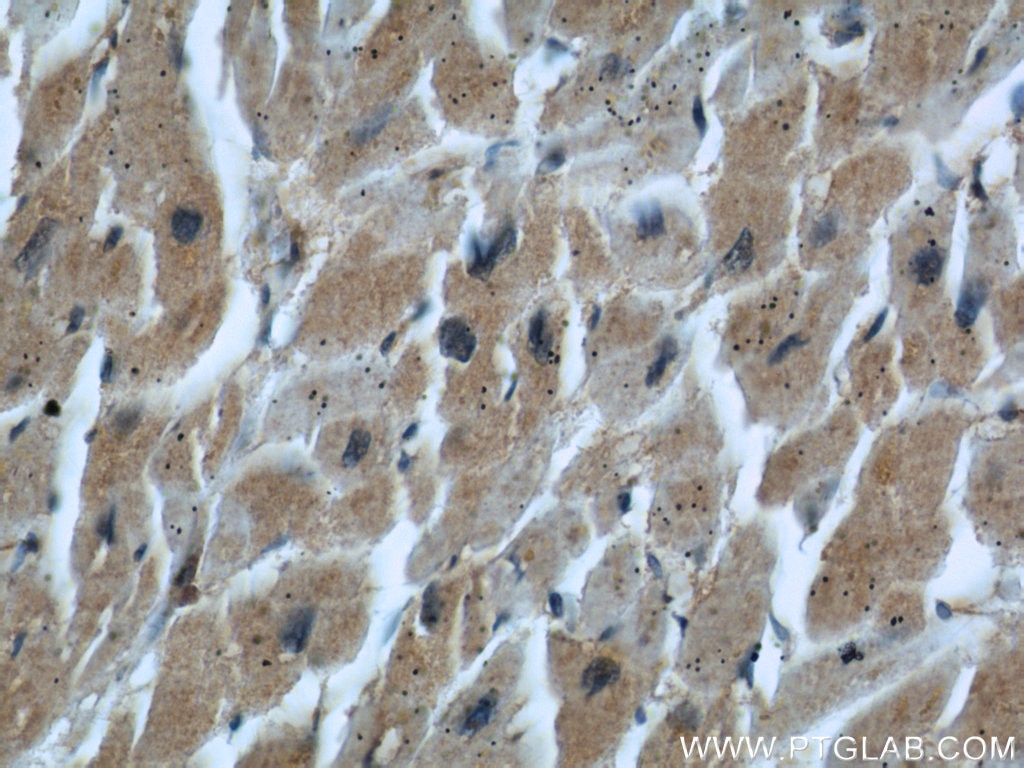 Immunohistochemistry (IHC) staining of human heart tissue using EPLIN Monoclonal antibody (66071-1-Ig)