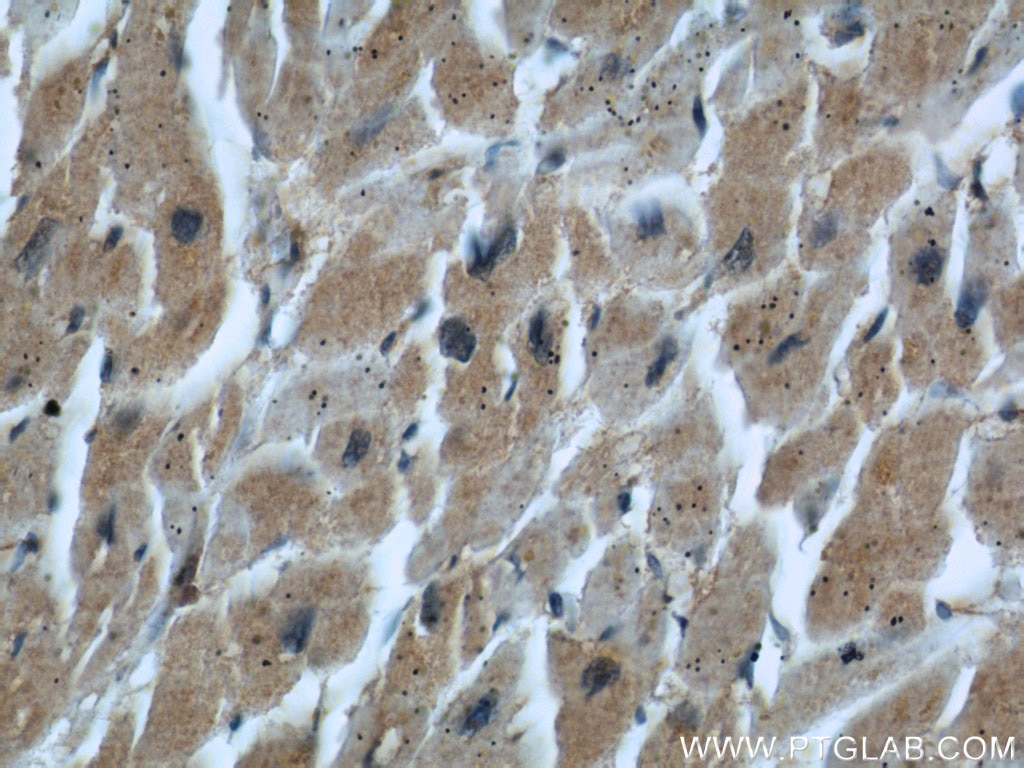 IHC staining of human heart using 66071-1-Ig