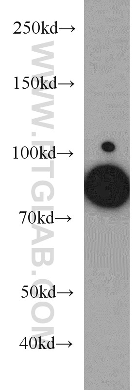 Western Blot (WB) analysis of HeLa cells using EPLIN Monoclonal antibody (66071-1-Ig)