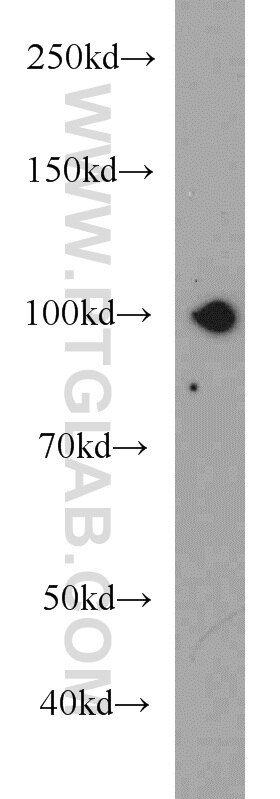 Western Blot (WB) analysis of human brain tissue using EPLIN Monoclonal antibody (66071-1-Ig)