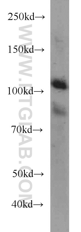 Western Blot (WB) analysis of HEK-293 cells using EPLIN Monoclonal antibody (66071-1-Ig)