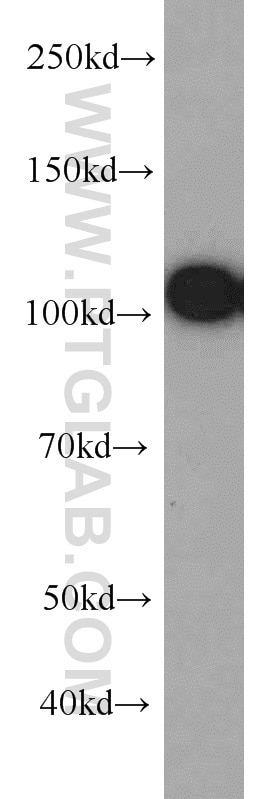 Western Blot (WB) analysis of COLO 320 cells using EPLIN Monoclonal antibody (66071-1-Ig)