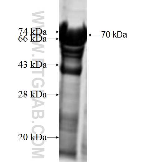 LIMA1 fusion protein Ag9994 SDS-PAGE