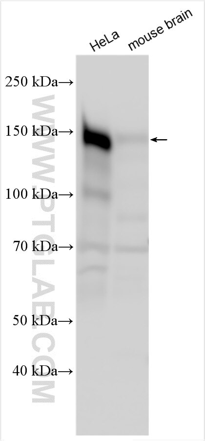 Western Blot (WB) analysis of various lysates using LIMCH1 Polyclonal antibody (26561-1-AP)