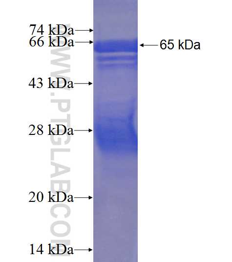 LIMCH1 fusion protein Ag24112 SDS-PAGE