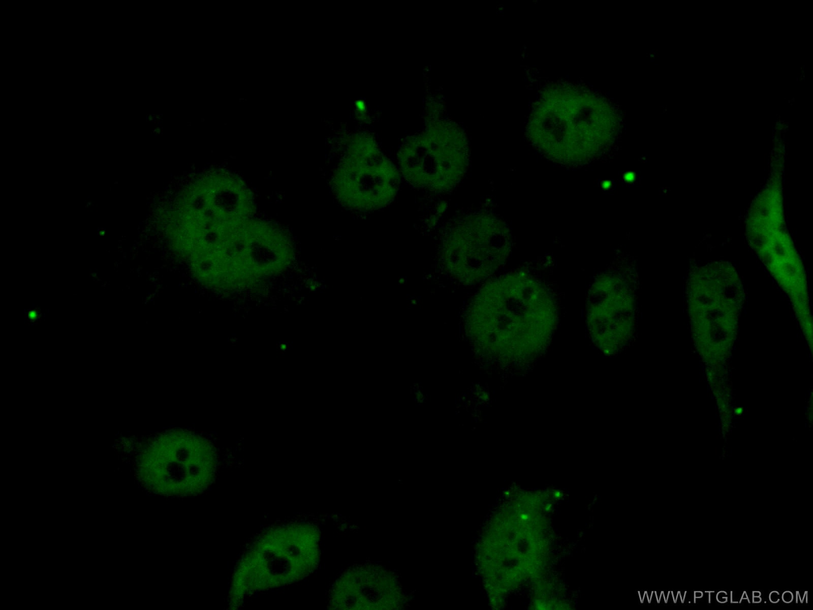 Immunofluorescence (IF) / fluorescent staining of HeLa cells using LIMD1 Polyclonal antibody (28106-1-AP)