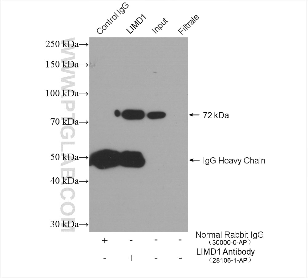 Immunoprecipitation (IP) experiment of HeLa cells using LIMD1 Polyclonal antibody (28106-1-AP)