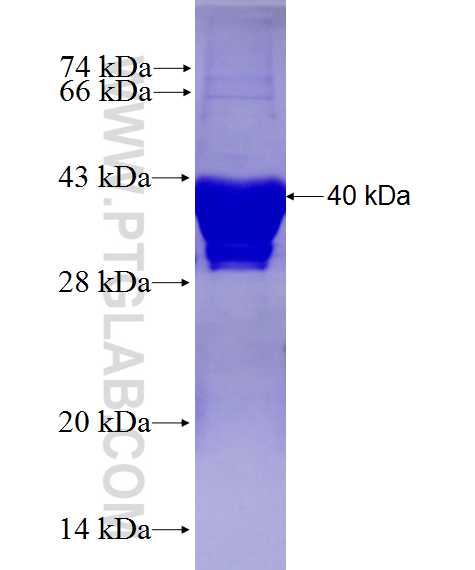 LIMD1 fusion protein Ag27974 SDS-PAGE