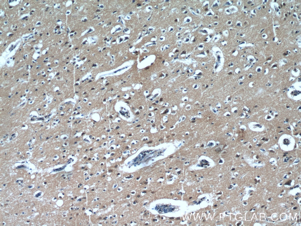 Immunohistochemistry (IHC) staining of human brain tissue using LIMD2 Polyclonal antibody (15471-1-AP)