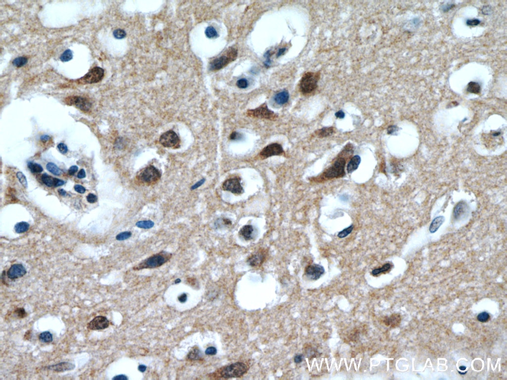 Immunohistochemistry (IHC) staining of human brain tissue using LIMD2 Polyclonal antibody (15471-1-AP)