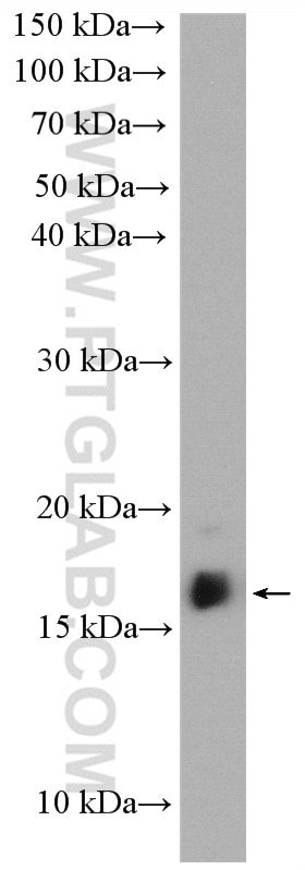 Western Blot (WB) analysis of Raji cells using LIMD2 Polyclonal antibody (15471-1-AP)