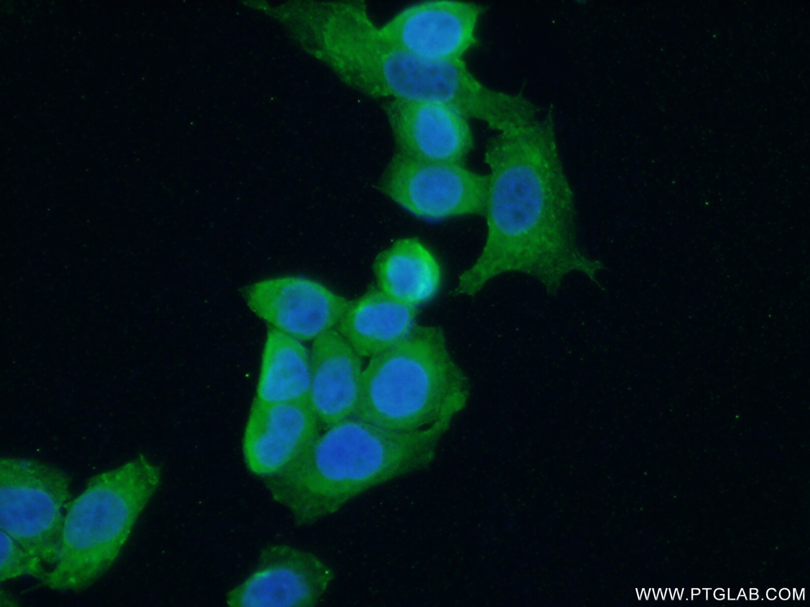 Immunofluorescence (IF) / fluorescent staining of HeLa cells using LIMK1 Polyclonal antibody (19699-1-AP)
