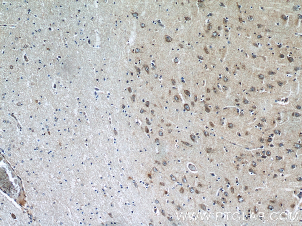 Immunohistochemistry (IHC) staining of human brain tissue using LIMK1 Polyclonal antibody (19699-1-AP)