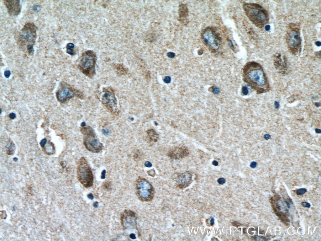 IHC staining of human brain using 19699-1-AP