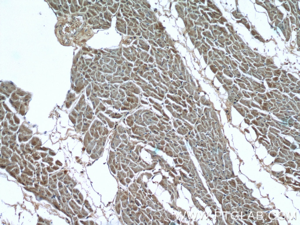 Immunohistochemistry (IHC) staining of human heart tissue using LIMK1 Polyclonal antibody (19699-1-AP)