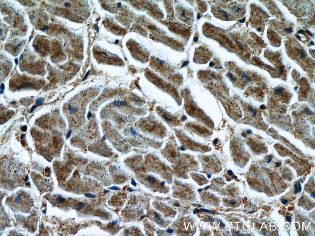 Immunohistochemistry (IHC) staining of human heart tissue using LIMK1 Polyclonal antibody (19699-1-AP)