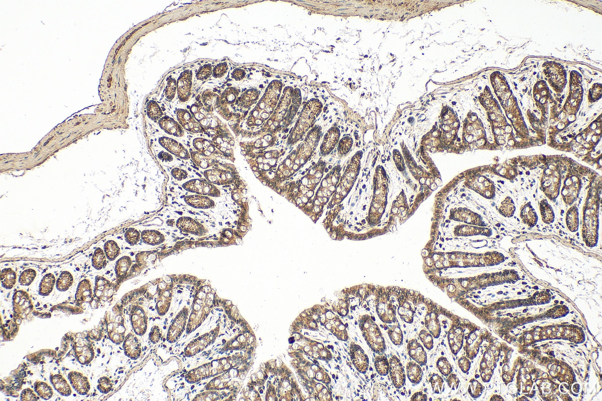Immunohistochemistry (IHC) staining of mouse colon tissue using LIMK1 Polyclonal antibody (19699-1-AP)