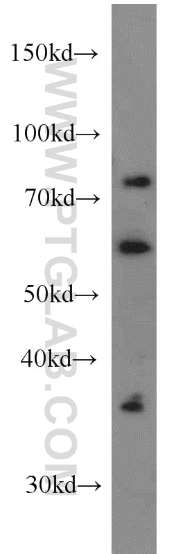 LIMK1 Polyclonal antibody