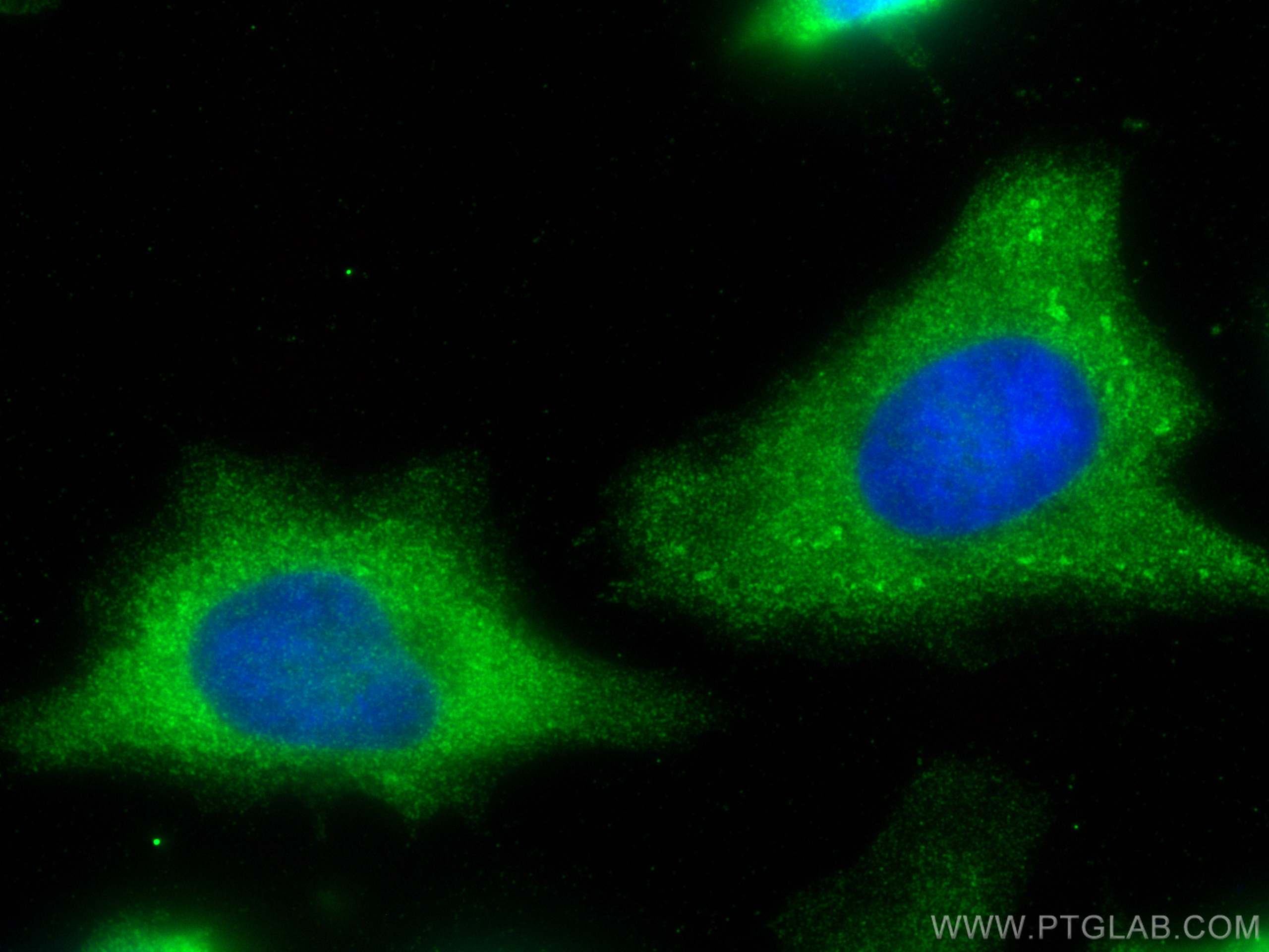 Immunofluorescence (IF) / fluorescent staining of HeLa cells using LIMK1 Monoclonal antibody (67974-1-Ig)
