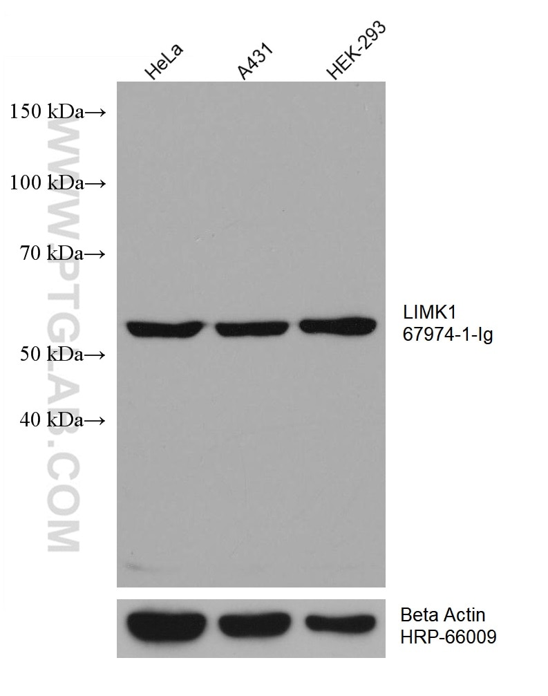 Western Blot (WB) analysis of various lysates using LIMK1 Monoclonal antibody (67974-1-Ig)