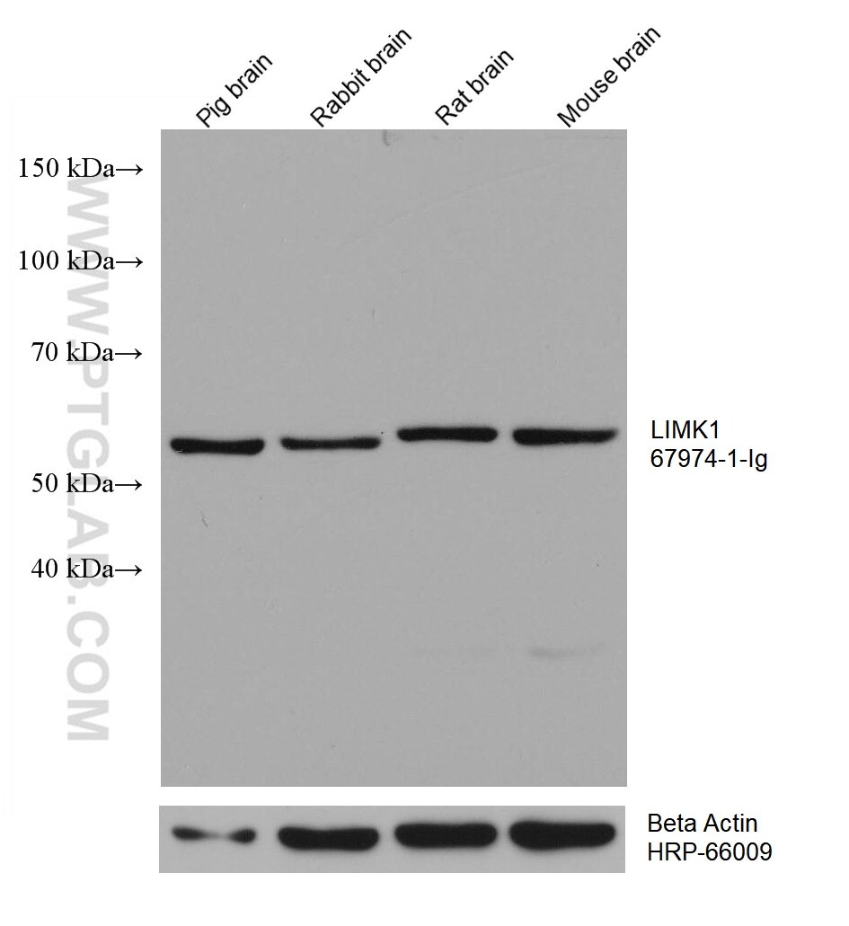 Western Blot (WB) analysis of various lysates using LIMK1 Monoclonal antibody (67974-1-Ig)