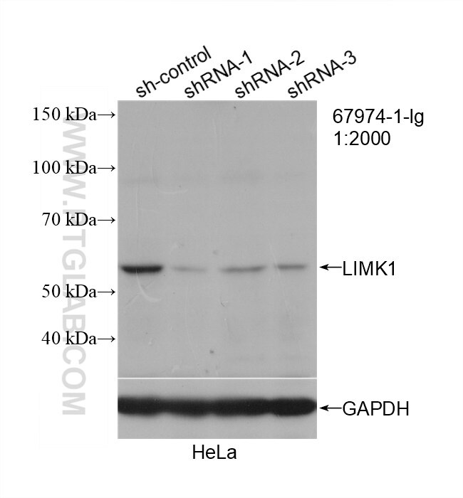 Western Blot (WB) analysis of HeLa cells using LIMK1 Monoclonal antibody (67974-1-Ig)