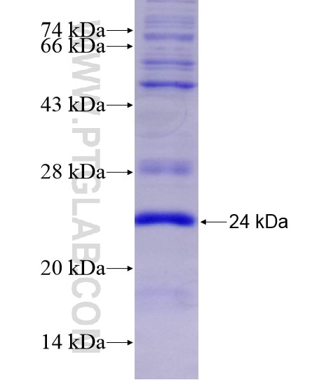 LIMK1 fusion protein Ag28862 SDS-PAGE