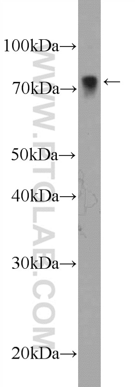 Western Blot (WB) analysis of NIH/3T3 cells using LIMK2 Polyclonal antibody (12350-1-AP)