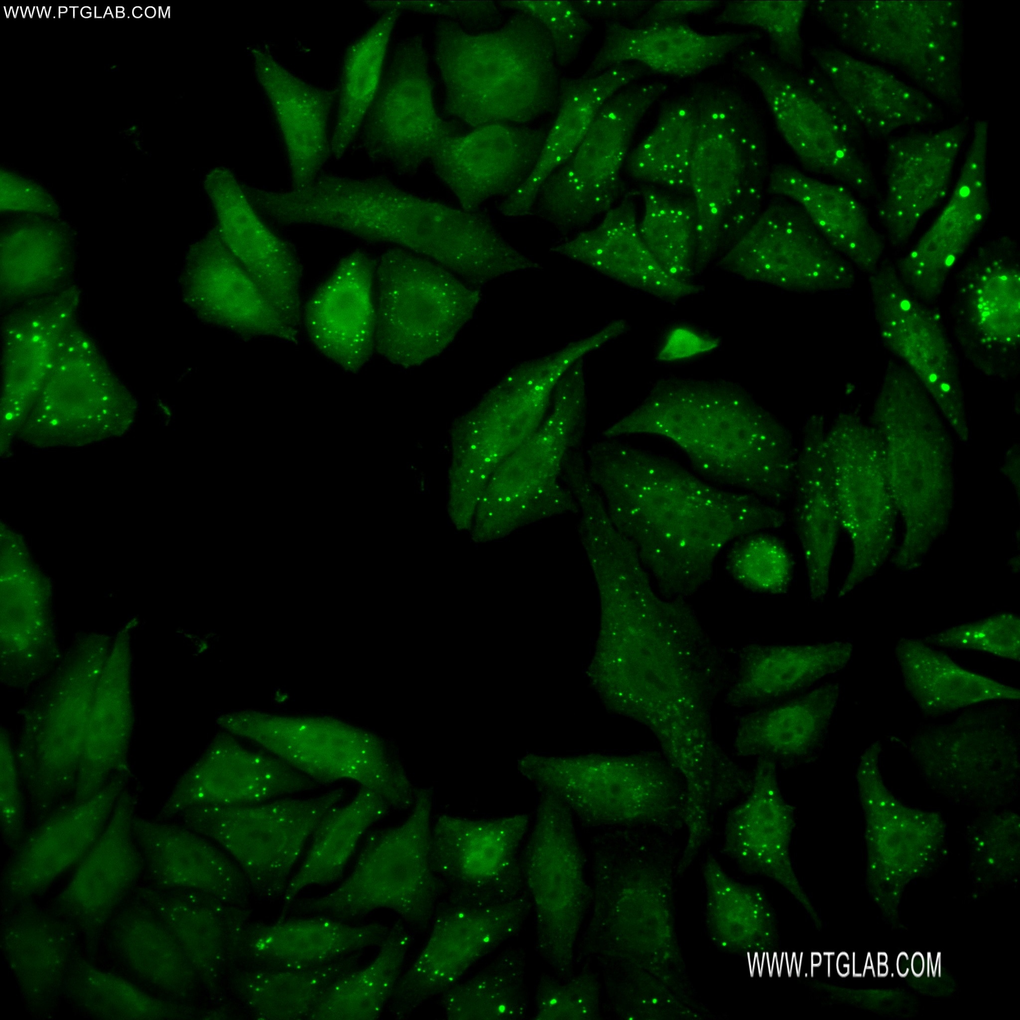 Immunofluorescence (IF) / fluorescent staining of HepG2 cells using LIMK2 Recombinant antibody (82977-1-RR)