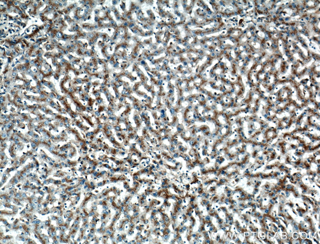Immunohistochemistry (IHC) staining of human liver tissue using LIMPII Polyclonal antibody (27102-1-AP)
