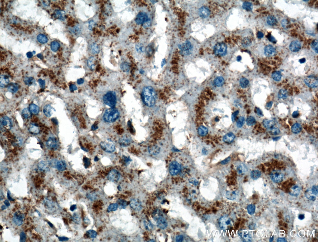 Immunohistochemistry (IHC) staining of human liver tissue using LIMPII Polyclonal antibody (27102-1-AP)