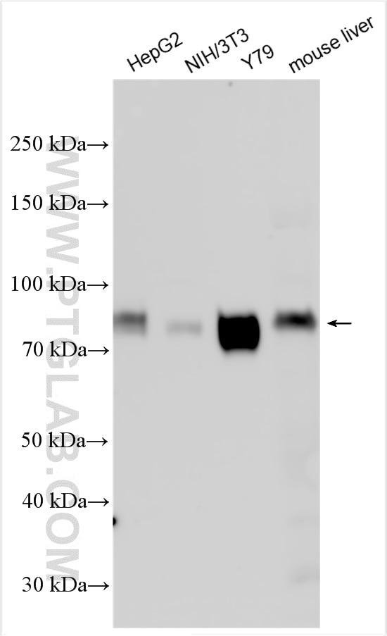 Western Blot (WB) analysis of various lysates using LIMPII Polyclonal antibody (27102-1-AP)