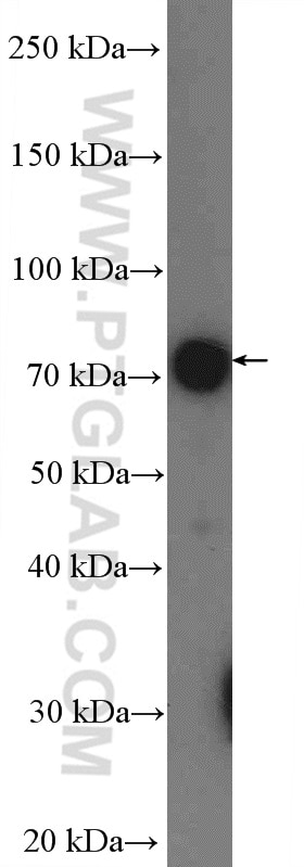 Western Blot (WB) analysis of mouse liver tissue using LIMPII Polyclonal antibody (27102-1-AP)