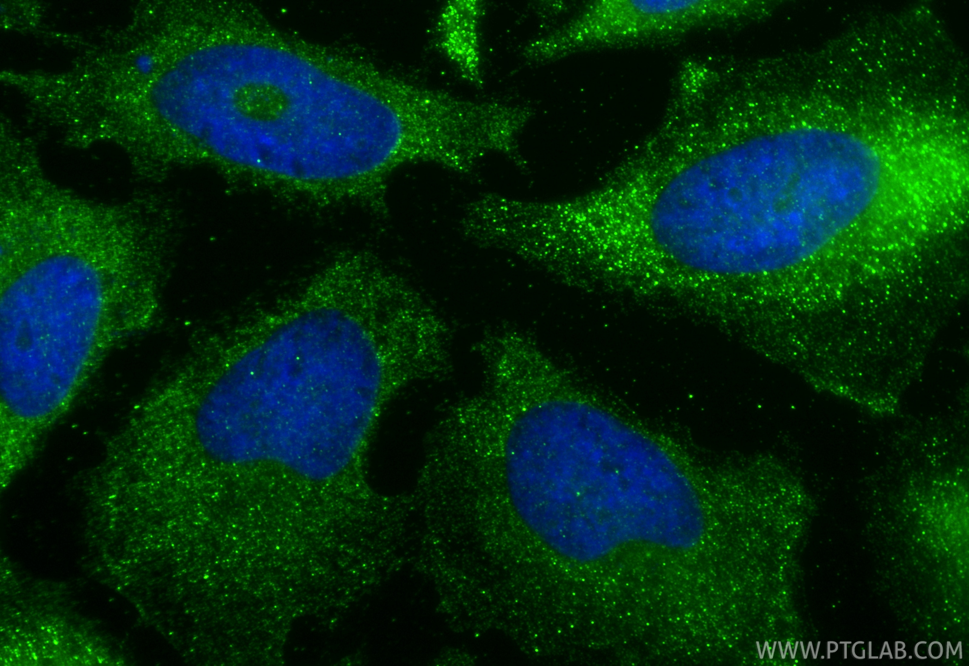 Immunofluorescence (IF) / fluorescent staining of HeLa cells using LIMS1 Polyclonal antibody (20772-1-AP)