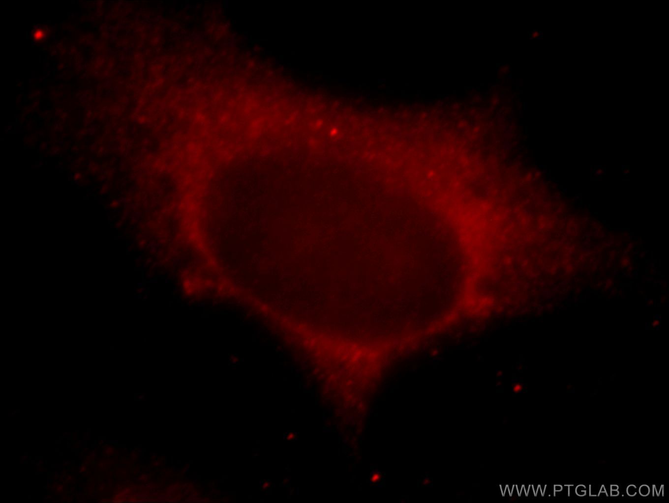 Immunofluorescence (IF) / fluorescent staining of HeLa cells using LIMS1 Polyclonal antibody (20772-1-AP)