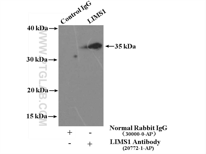 Immunoprecipitation (IP) experiment of K-562 cells using LIMS1 Polyclonal antibody (20772-1-AP)