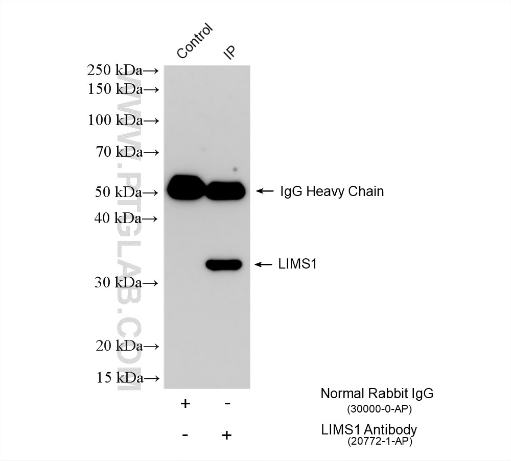 Immunoprecipitation (IP) experiment of K-562 cells using LIMS1 Polyclonal antibody (20772-1-AP)
