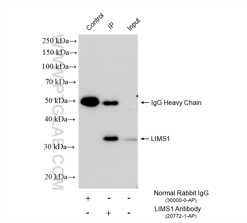 Immunoprecipitation (IP) experiment of K-562 cells using LIMS1 Polyclonal antibody (20772-1-AP)
