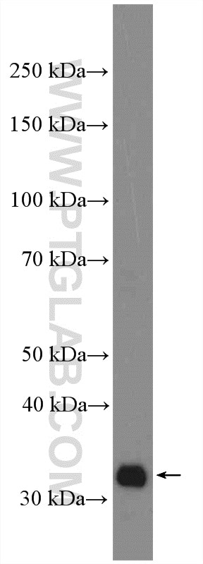 Western Blot (WB) analysis of Caco-2 cells using LIMS1 Polyclonal antibody (20772-1-AP)