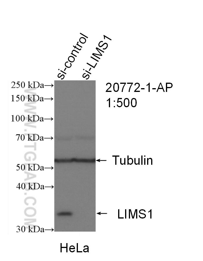 Western Blot (WB) analysis of HeLa cells using LIMS1 Polyclonal antibody (20772-1-AP)