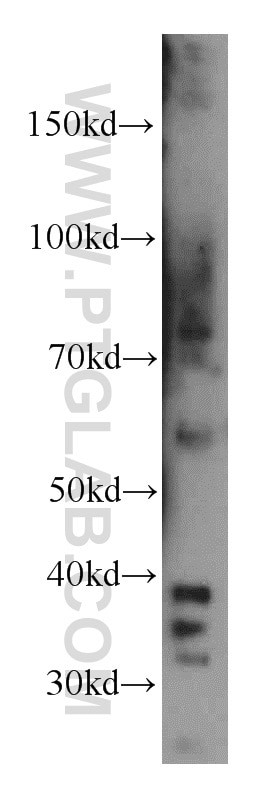 Western Blot (WB) analysis of mouse lung tissue using LIMS1 Polyclonal antibody (20772-1-AP)