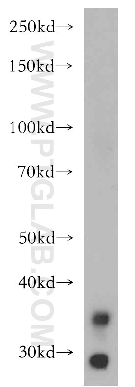 Western Blot (WB) analysis of human kidney tissue using LIMS1 Polyclonal antibody (20772-1-AP)